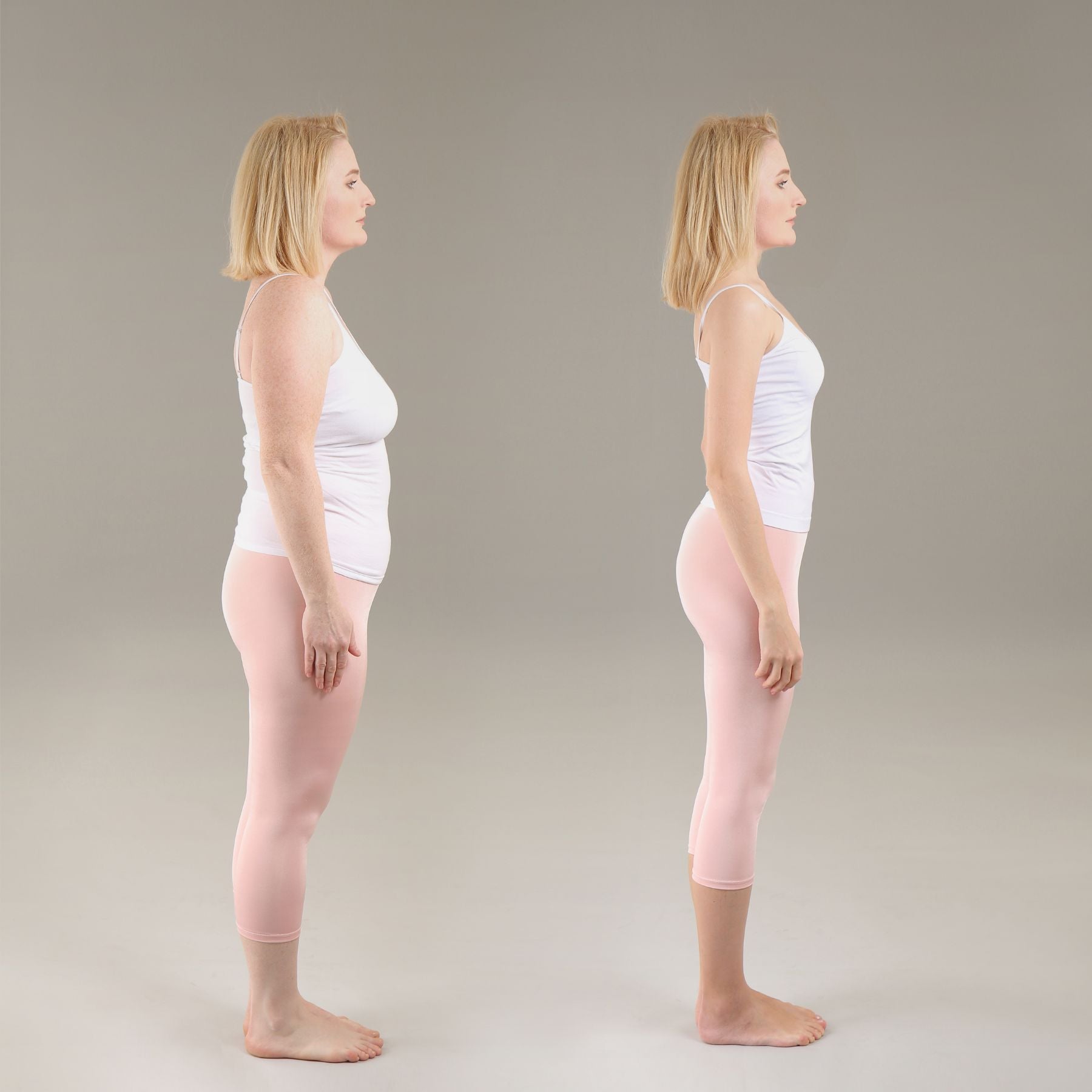 Side-by-side comparison of woman before and after body contouring.