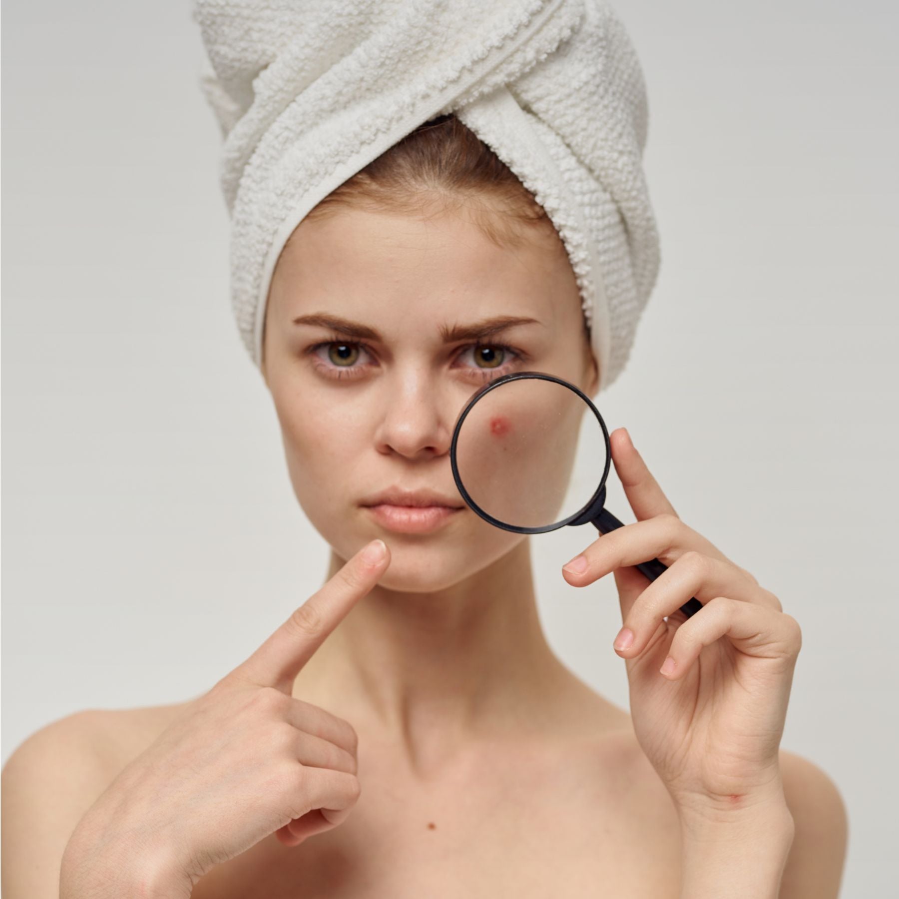 Woman with a towel on her head examining acne on her cheek through a magnifying glass.