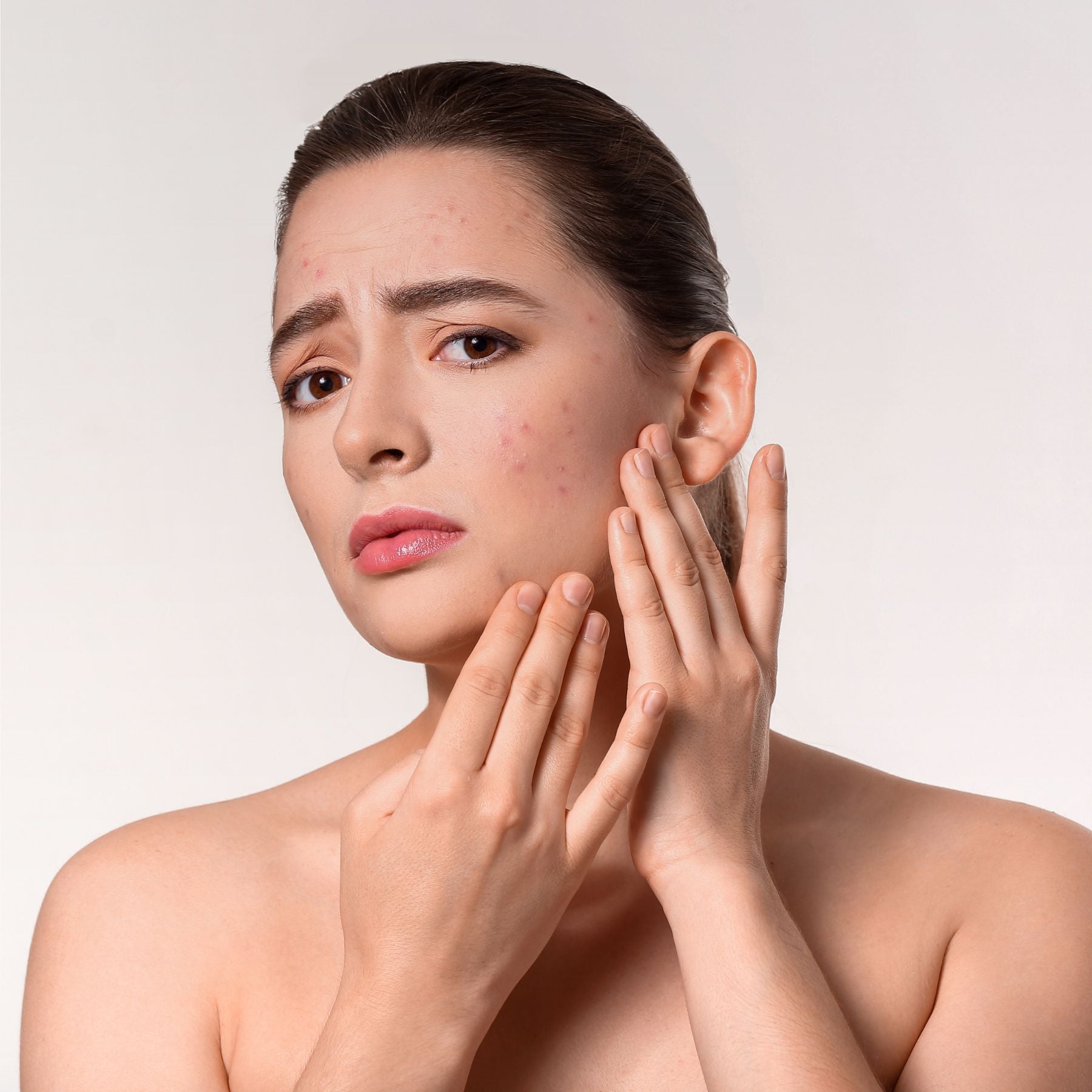 Young woman with acne touching her cheek, looking concerned against a plain background.